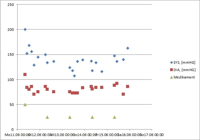 Excel Punkt Xy Diagramm Kombiniert Mit Balkendiagramm Kuettner It